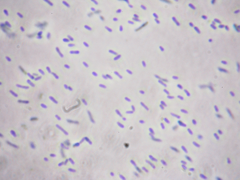 Newswise: Microbes Promote Lima Bean Growth