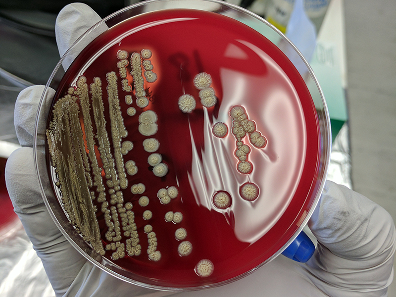 Aislamiento bacteriano de la basura reutilizada con potencial de exclusión competitiva contra Salmonella que crece en agar sangre de oveja. Crédito: Caroline Plymel placa de Petri con bacterias en crecimiento