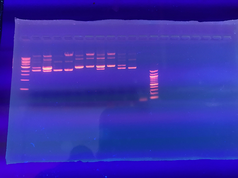 La electroforesis es una técnica científica utilizada para separar moléculas de ADN o proteínas. La forma en que las moléculas viajan a través del gel, que se muestra aquí, ayuda a los científicos a comprender características importantes. Crédito: Jonathan Windham gel de electroforesis bajo luz ultravioleta
